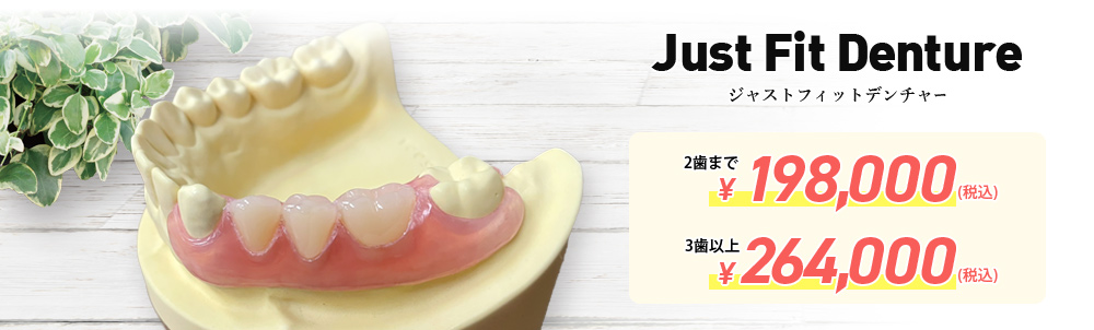 Just Fit Denture ジャストフィットデンチャー(ノンクラスプデンチャー)